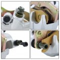 Gxywady Front Left And Right Brake Calipers With Pads Replacement For Kawasaki Teryx 750 800 Krf800 2014 2015 2016 2017 2018